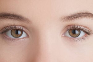Are Under Eye Fillers Effective for Mild Eye Hollows