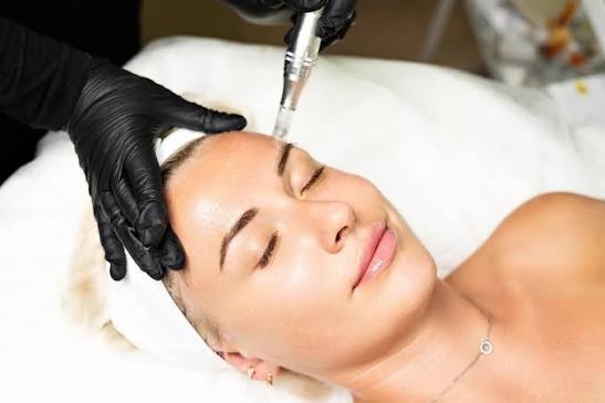 Does Salmon DNA Treatment help improve skin elasticity