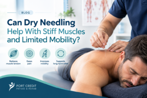 Can Dry Needling Help With Stiff Muscles and Limited Mobility?