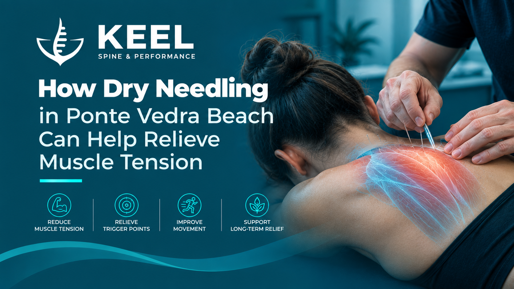 Dry Needling in Ponte Vedra Beach