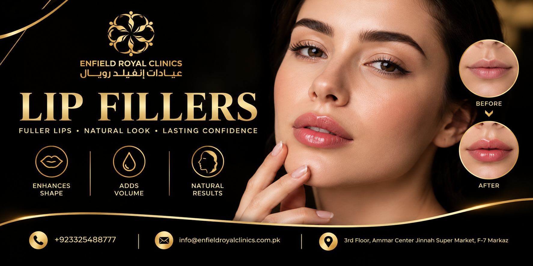Lip Fillers in islamabad