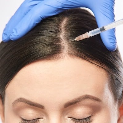 prp hair treatment in pune