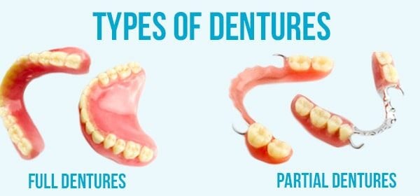 Partial Dentures vs. Full Dentures: Cost and Comfort Compared