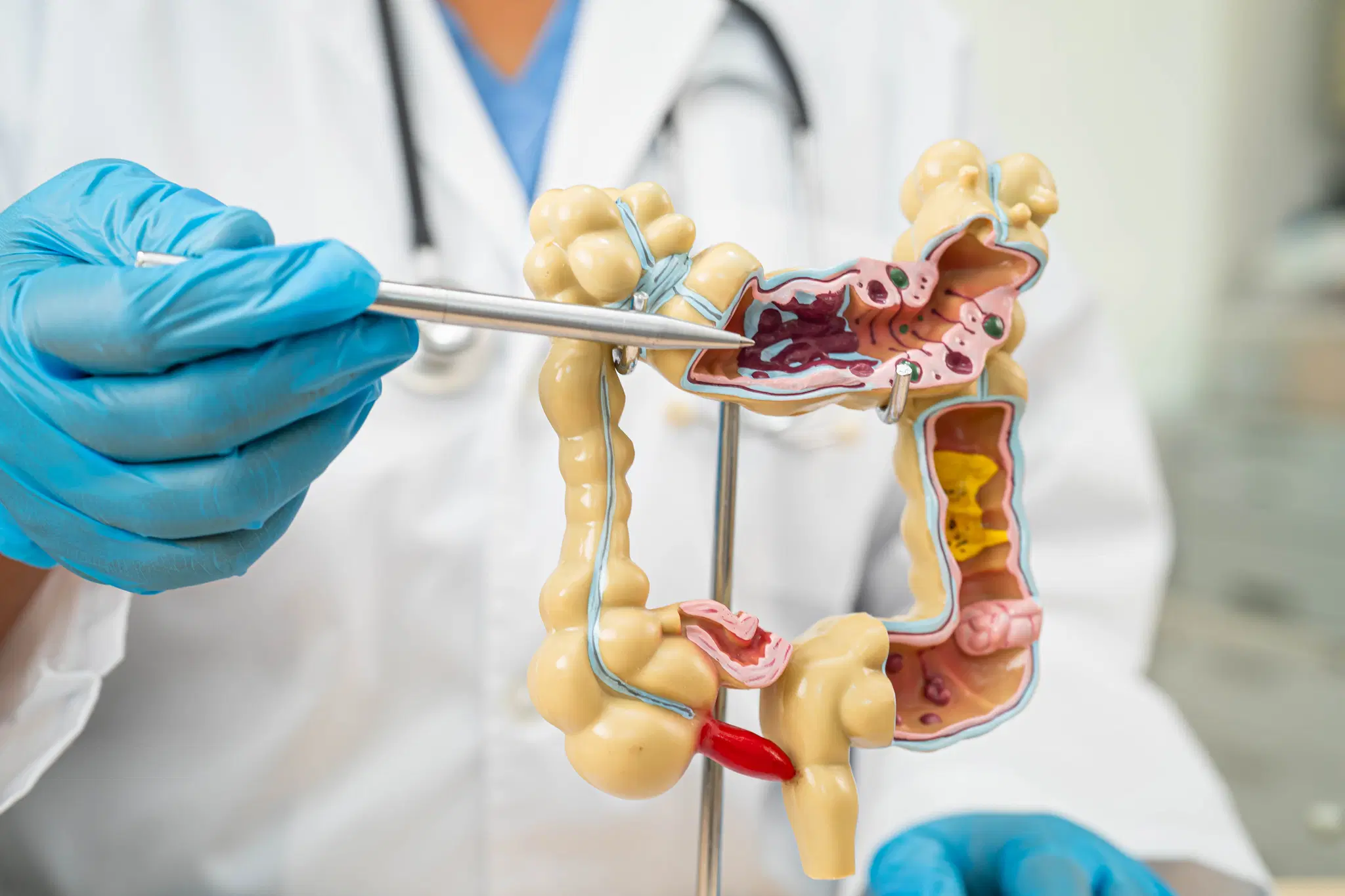 Piles Treatment in Navi Mumbai