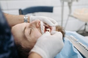 Porcelain Veneers