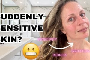 Sensitive Skin After 40 with a gentle skincare routine to reduce irritation and dryness