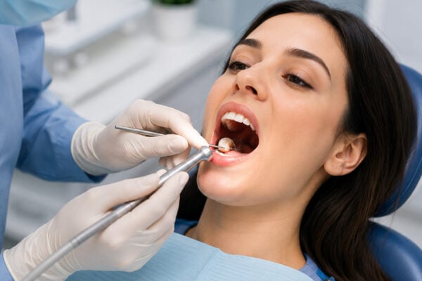 Tooth Filling Cost in Houston Without Insurance