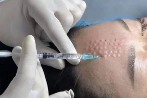 What Can Skin Glowing Injections Do for Glow