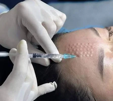 What Can Skin Glowing Injections Do for Glow