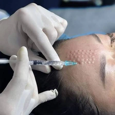 What Can Skin Glowing Injections Do for Glow