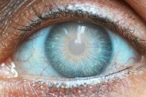 home eye test