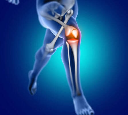 orthopedic doctor Ambikapur