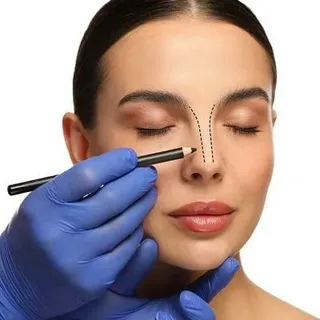 rhinoplasty in RIYADH
