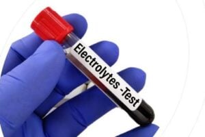 serum electrolytes test price